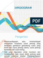 Phonocargiogram (PCG)