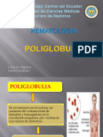 Poliglobuliaaa