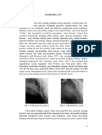 Myocardial Bridging