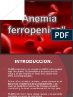 Anemia Ferropenica