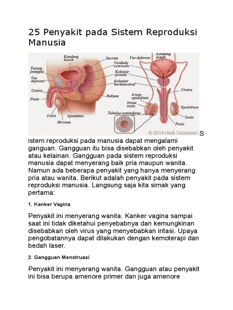 25 Penyakit Pada  Sistem  Reproduksi  Manusia 