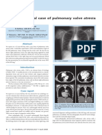 Unusual Case of Pulmonary Valve Atresia Sajr 2008.Zp42515