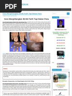 Download Cara Menghilangkan Bintik Putih Tapi Bukan Panu  OBAT GINJAL BENGKAK by Agus Salam SN295073581 doc pdf