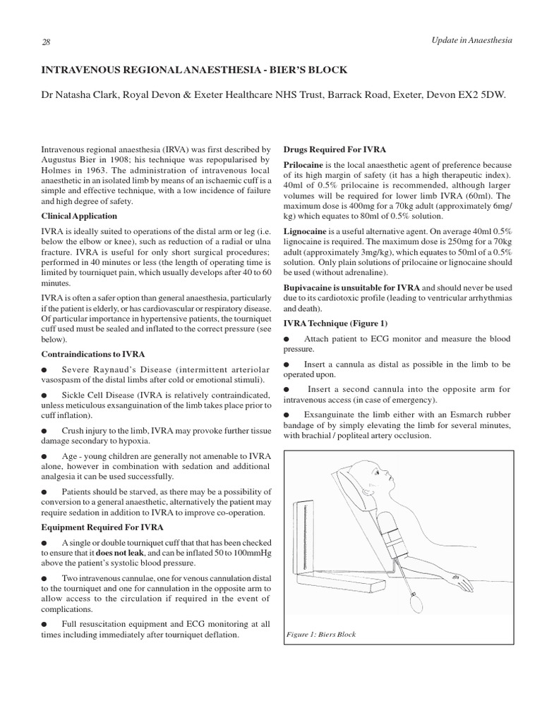 Bier's Block: IVRA Technique Overview | PDF | Anesthesia | Intravenous ...