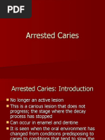 Download Arrested Caries by marialatoya SN29512615 doc pdf