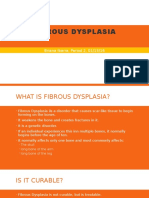 Fibrous Dysplasia: Briana Ibarra, Period 2, 01/13/16