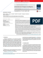 Duodenal Gangliocytic Paraganglioma