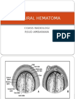 Epidural Hematoma 8-15