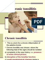 Tonsilitis kronis