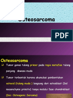 Osteosarcoma