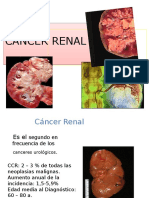 Cancer Renal 1