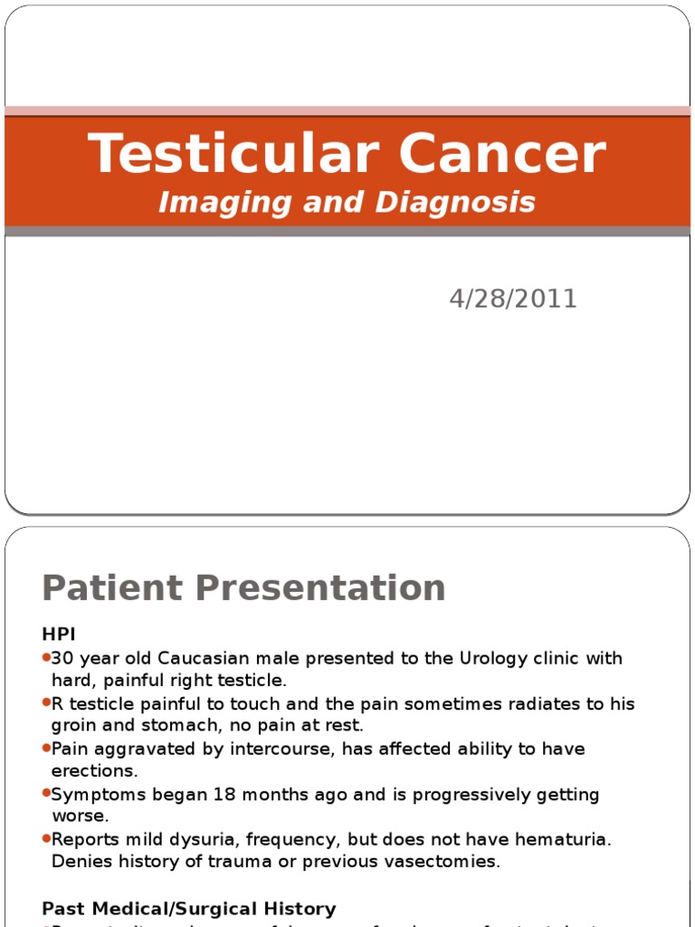 Testicular Cancer Metastasis Testicle