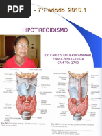 Hipotireoidismo 