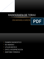 Graficos de Radiografia de Torax 