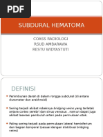 Subdural Hematoma