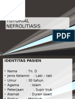 Nefrolitiasis