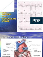 Ekg Normalaritmiaima