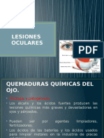 Lesiones Oculares