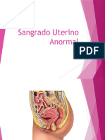 Sangrado Uterino Anormal 