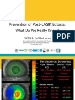 Post LASIK Ectasia