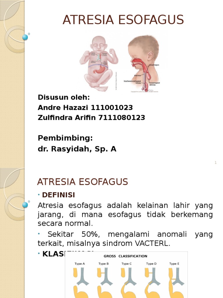 Atresia Esofagus | PDF | Kesehatan Holistik | Sains & Matematika