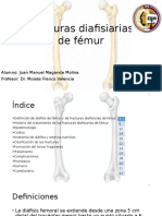 Fracturas Diafisiarias de Fémur