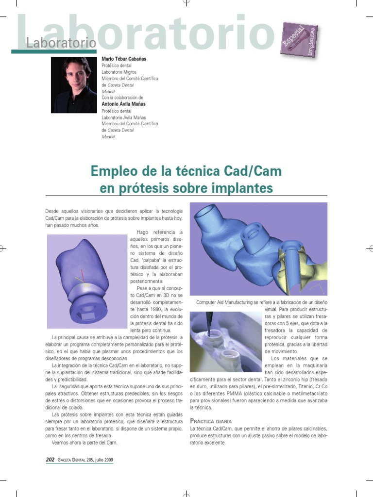 Protesis Cad:cam PDF | PDF | Titanio | Dentadura postiza