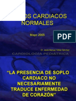 Descripcion medica cientifica de un soplo cardiaco 