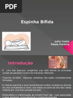 Espinha Bifida