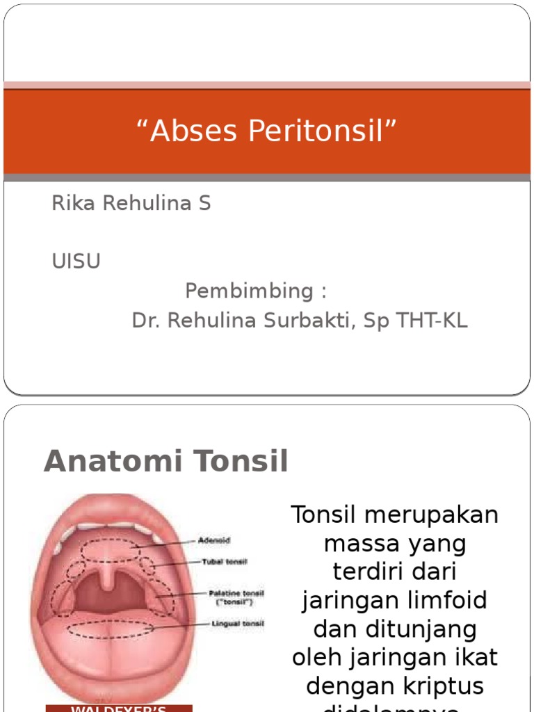 Abses Peritonsil | PDF