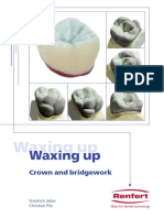 waxing-up