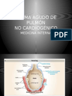 Edema Pulmonar