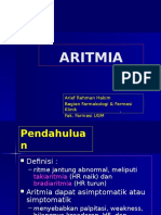 Aritmia