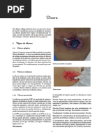 Úlcera  que son y tipos