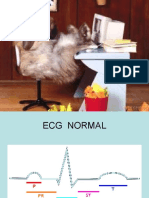 EKG Curso I