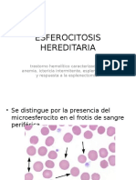 Esferocitosis Hereditaria
