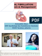 Diagnosis & Management: Atrial Fibrillation