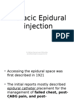 Thoracic Epidural Injection