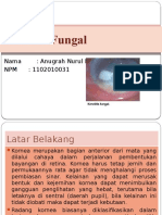 PPT Keratitis Fungal