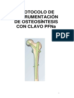 Instrumentacion con clavo PFNa- traumatologia