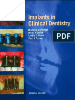 Implants in Clinical Dentistry 2002 Palmer