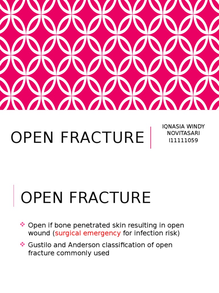 Open Fracture PDF Injury Wound