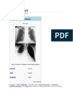 Chest Radio Graph Wikipedia