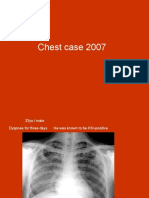 Chest Case 2007