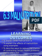 Malnutrition edited .ppt