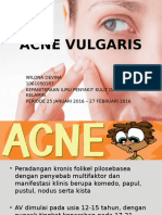 ACNE VULGARIS PENYEBAB DAN GEJALA