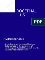 Understanding Hydrocephalus