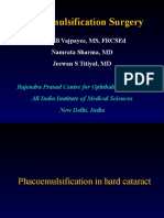 Phacoemulsification Surgery Guide for Hard Cataracts