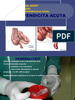 Apendicita Acuta