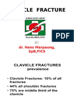 Clavicula Fracture